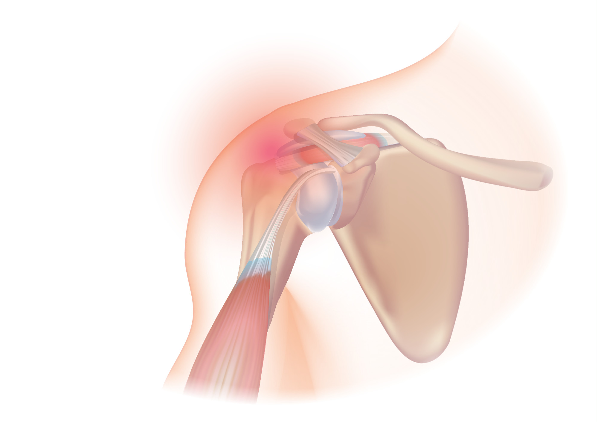 rotator cuff 1